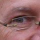 BBB-N. Augen